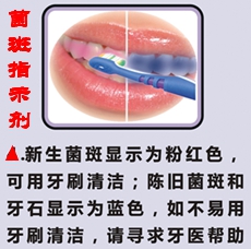 泰丝美“快显”双色菌斑指示剂